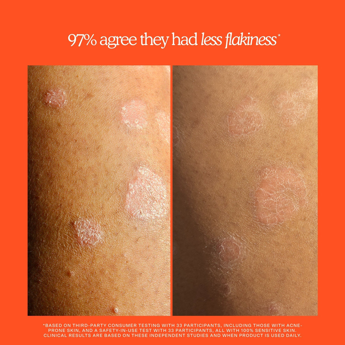SOS Rescue + Relief Body Wash Treatment O6