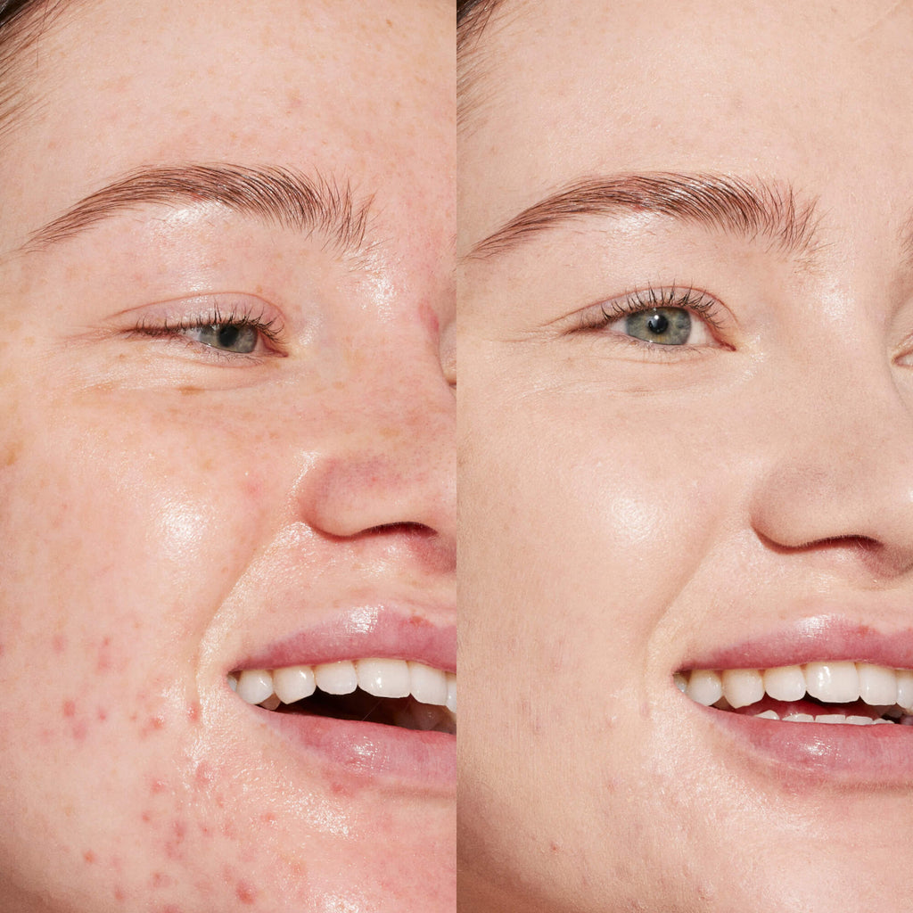 Swipe Serum Concealer® P6